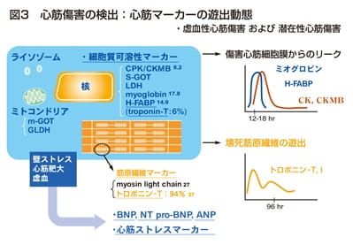 心筋障害の検出