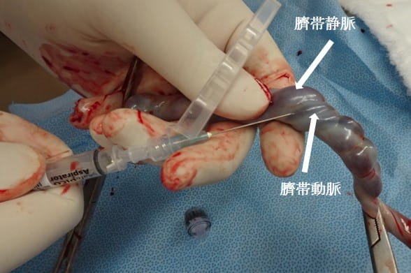 臍帯動脈からの採血