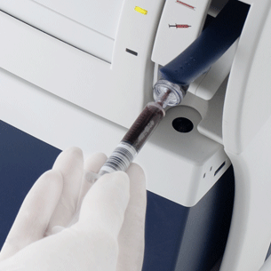 血液ガス分析装置